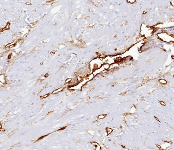IHC staining of FFPE human uterus tissue with CD34 antibody (clone CD34/7719) at 2ug/ml. HIER: boil 