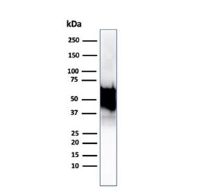 Western blot testing of human Hep2 cell lysate using recombinant HSP60 antibody (clone rHSPD1/6495).