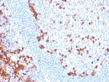 B7-H6 Antibody / NCR3LG1