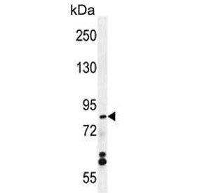 Western blot testing of human MCF7 cell lysate with WDR27 antibody. Predicted molecular weight ~90 k