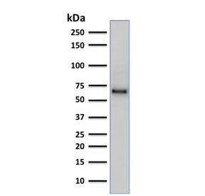 Western blot testing of human PC3 cell lysate using SOX9 antibody (clone SOX9/2387). Predicted molec