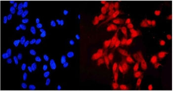 Immunofluorescent staining of FFPE human U-2 OS cells with NDC80 antibody (red) and DAPI nuclear sta