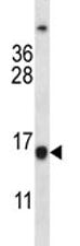 BCL2 Antibody