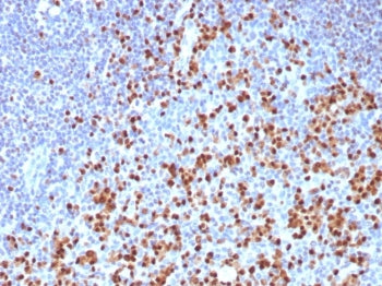 IRF4 Antibody / Interferon regulatory factor 4 / MUM-1