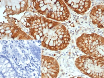 IHC staining of FFPE human colon tissue with Galectin 3 antibody (clone LGALS3/7145). Inset: PBS use