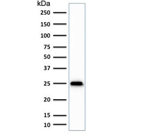 Western blot testing of human brain lysate with anti-UchL1 antibody (clone SPM575). Predicted molecu
