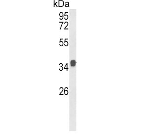 Western blot testing of mouse stomach lysate with KLF6 antibody. Expected molecular weight: 32-40 kD