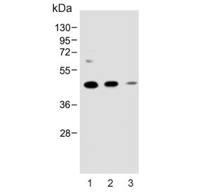 Western blot testing of 1) human MDA-MB-231, 2) mouse NIH 3T3 and 3) rat C6 cell lysate with MAP2K1 