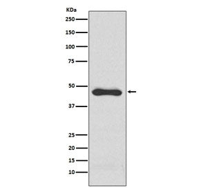 Western blot testing of human HepG2 cell lysate with PAI-1 antibody. Predicted molecular weight ~45 