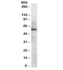 Western blot testing of HepG2 lysate with ERp57 antibody at 1ug/ml. Predicted molecular weight: ~57-