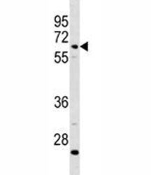 Complement C8 beta Antibody (C8B)
