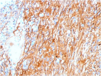 FN1 Antibody / Fibronectin