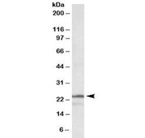 Western blot testing of K562 lysate with PSMB3 antibody at 1ug/ml. Predicted molecular weight: ~23 k