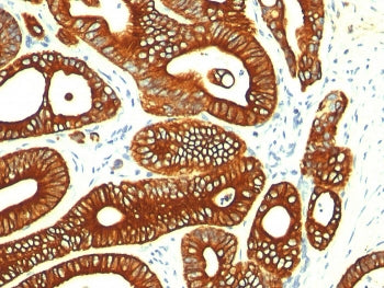 Cytokeratin 18 Antibody
