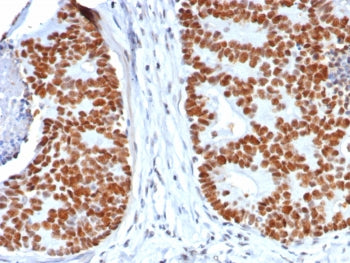 p53 Antibody / TP53