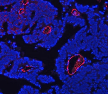 CD105 Antibody / Endoglin