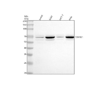 Western blot analysis of TXNRD1 using anti-TXNRD1 antibody. Lane 1: human Jurkat whole cell lysates,