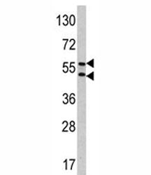 Western blot analysis of CA9 antibody and HeLa lysate. Predicted molecular weight: 58 kDa and 54 kDa