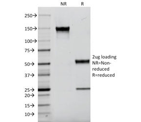 SDS-PAGE analysis of purified, BSA-free CD9 antibody (clone P1/33/2) as confirmation of integrity an