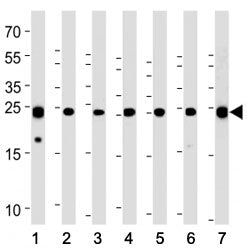PGP9.5 antibody western blot analysis with (1) U266, (2) SH-SY5Y, (3) NCI-H1299, (4) mouse Neuro-2a,