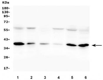 Western blot testing of human 1) A375, 2) Jurkat, 3) A549, 4) A431, 5) HepG2 and 6) K562 cell lysate