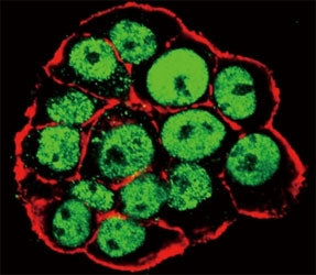 Confocal immunofluorescent analysis of phospho CDX2 antibody and WiDr cells followed by Alexa Fluor 