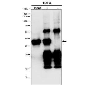 Immunoprecipitation of MAS1L protein from 500ug of human HeLa whole cell lysate with MAS1L antibody 