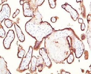 Placental Alkaline Phosphatase Antibody / ALPP