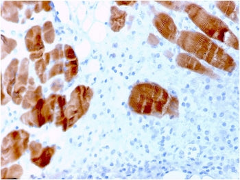 IHC staining of FFPE human skeletal muscle tissue with ACTN2 antibody. HIER: boil tissue sections in