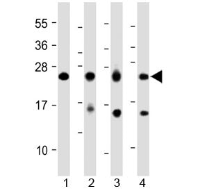 Western blot testing of 1) human heart, 2) human skeletal muscle, 3) mouse skeletal muscle and 4) ra
