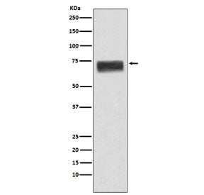 Western blot testing of human fetal liver lysate with Hemopexin antibody. Predicted molecular weight