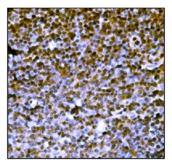 IHC staining of FFPE mouse lymph node tissue with Protein PML antibody. HIER: boil tissue sections i