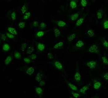 PIN1 Antibody / Peptidyl-prolyl cis-trans isomerase NIMA-interacting 1