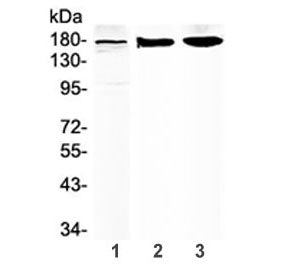 Western blot testing of 1) human placenta, 2) rat brain and 3) mouse brain lysate with SUR1 antibody