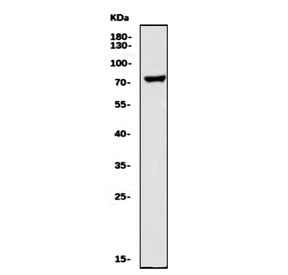 GnRH Receptor Antibody / LHCG Receptor