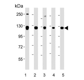 Western blot testing of human 1) HeLa, 2) K562, 3) NCCIT, 4) SH-SY5Y and 5) T-47D cell lysate with R
