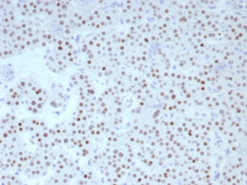 IHC staining of FFPE human parathyroid tissue with FOXL2 antibody (clone FOXL2/8701R). HIER: boil ti
