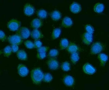 Immunofluorescent staining of FFPE human SiHa cells with PDGF alpha antibody (green) and DAPI nuclea