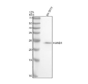 Western blot analysis of HAND1 using anti-HAND1 antibody. Electrophoresis was performed on a 12% SDS