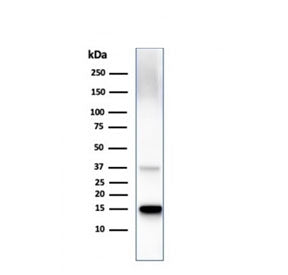 TTR Antibody / Transthyretin / Prealbumin
