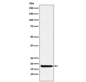 Western blot testing of human pituitary lysate with TSH beta antibody. Predicted molecular weight ~1