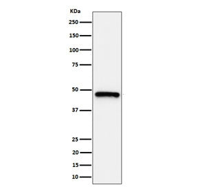 Western blot testing of human HeLa, cell lysate with ING1 antibody. Expected molecular weight ~47 kD