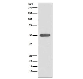 Western blot testing of human HeLa cell lysate with ESRRA antibody. Expected molecular weight: 46-52