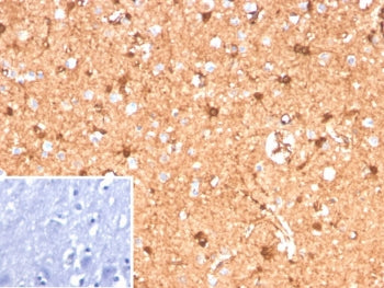 IHC staining of FFPE human brain tissue with recombinant S100B antibody (clone S100B/12587R). Inset: