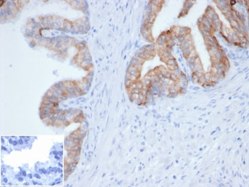 Pan Cytokeratin Antibody Cocktail