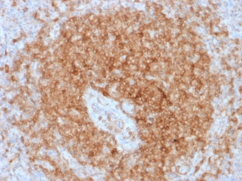 IHC testing of FFPE human spleen with recombinant CD79a antibody (clone rIGA/764). Required HIER: bo