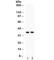 FRZB Antibody