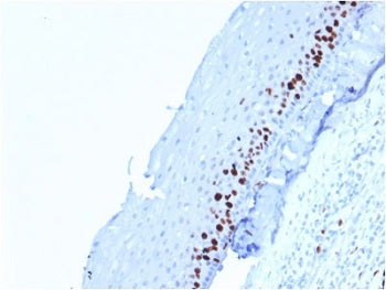 IHC testing of FFPE human skin stained with Ki67 antibody (MKI67/2462). Required HIER: boiling tissu