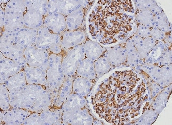 IHC staining of FFPE human kidney tissue with CD34 antibody (clone HPCA1/8333R). HIER: boil tissue s