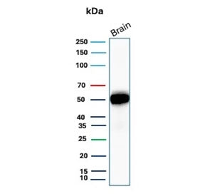 Western blot testing of human brain tissue with GFAP antibody. Predicted molecular weight ~50 kDa.